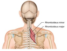 rhomboid muscle knot
